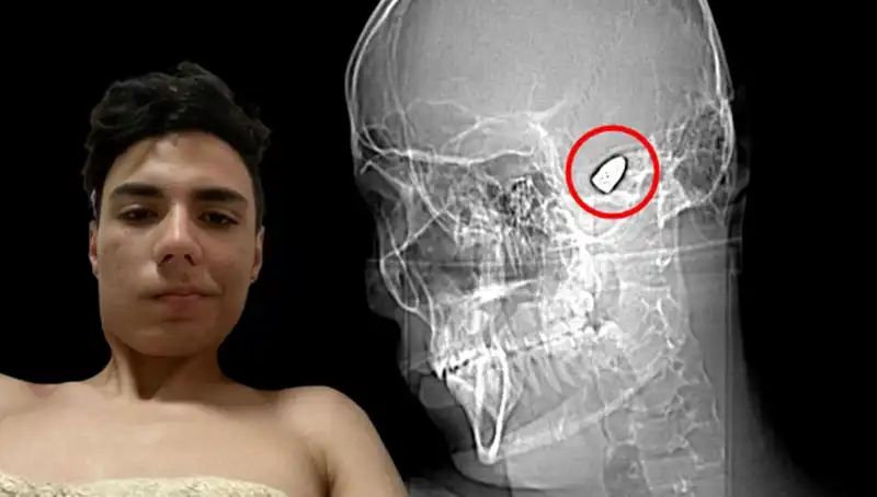 Kafasında Patlayan Düşünceler: Bomba Gibi Bir Hayat