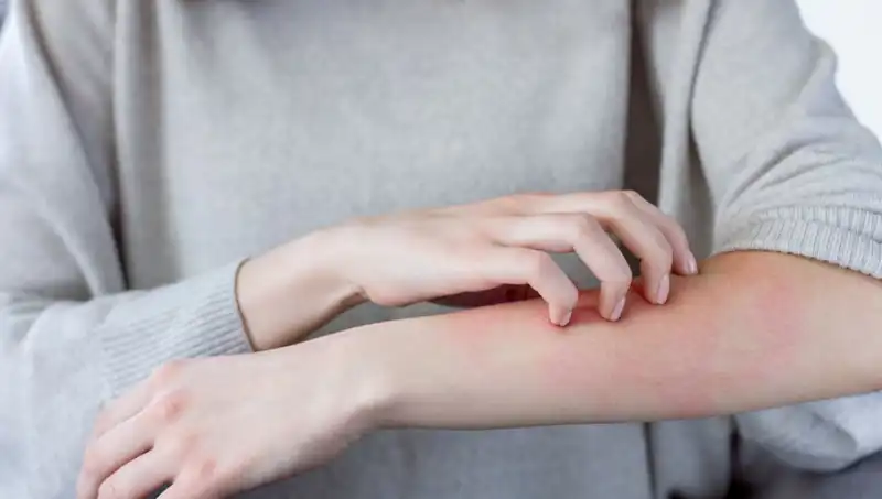 Cilt Kanseri Belirtilerini Kaçırmamak İçin Dermatologdan Önemli Açıklamalar