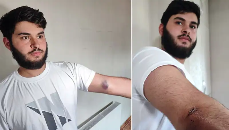 Bahçeye Kaçan Topun Yol Açtığı Olay: "Conolar Kamyonetle Geldi"